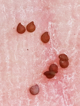 Spergularia marina